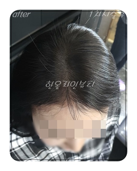 가르마문신