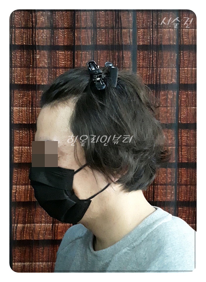 두피타투