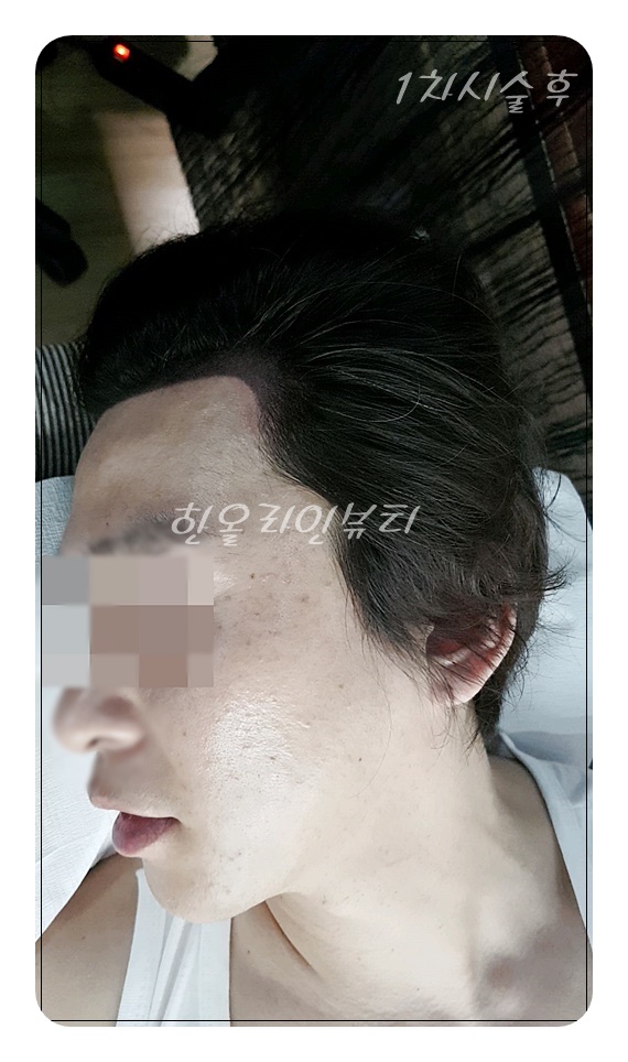 밀도보강