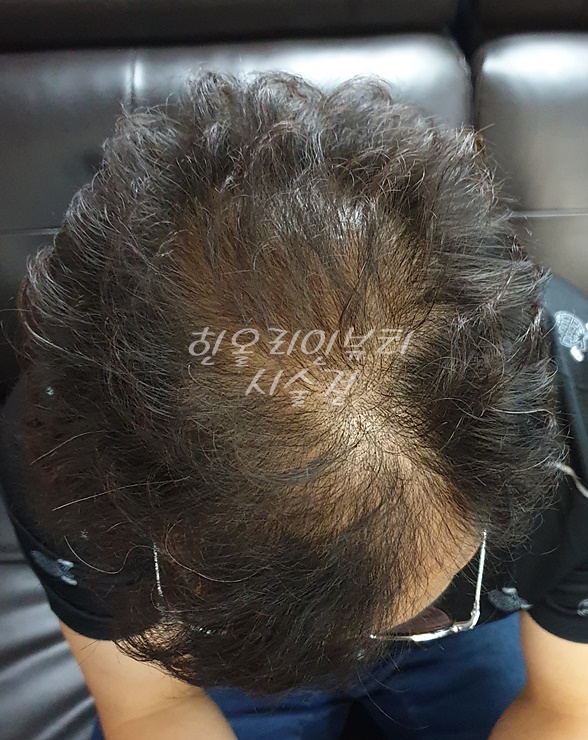 한올라인뷰티스칼프