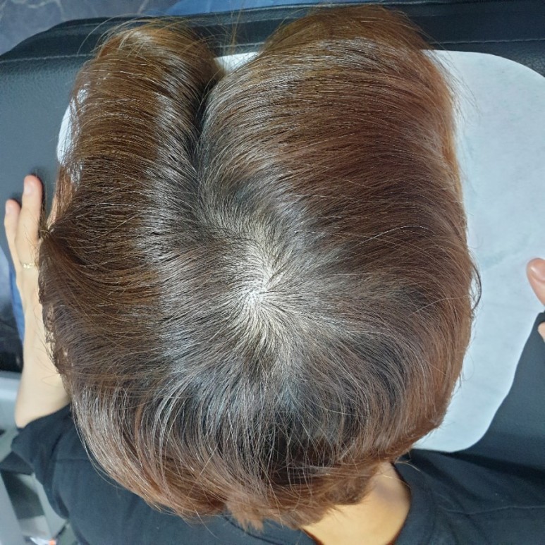 포천두피문신