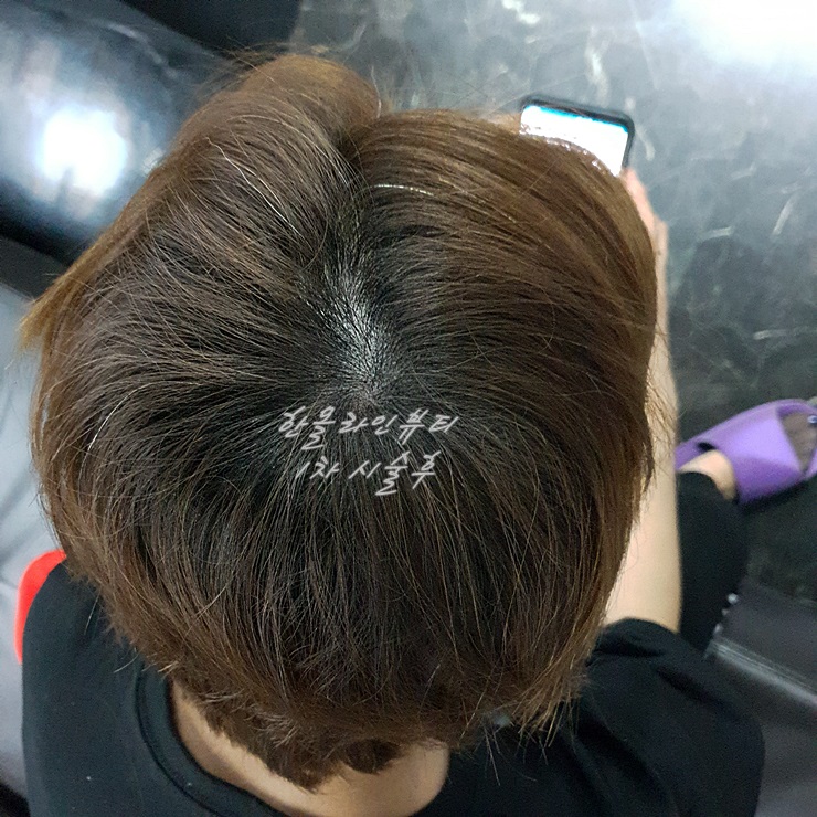 여성탈모커버