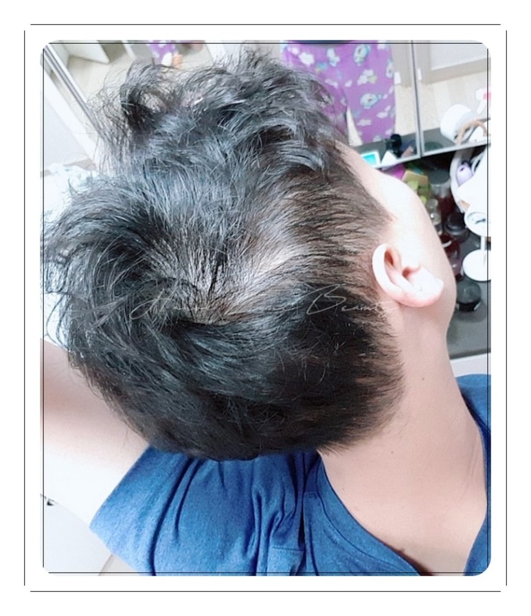 파주두피문신
