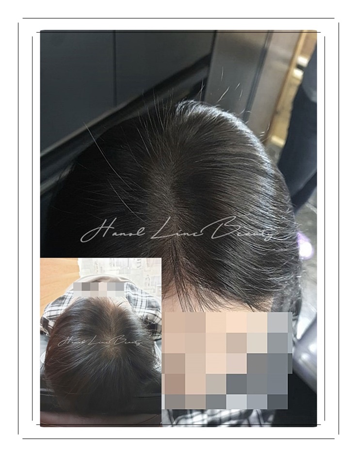 가르마문신