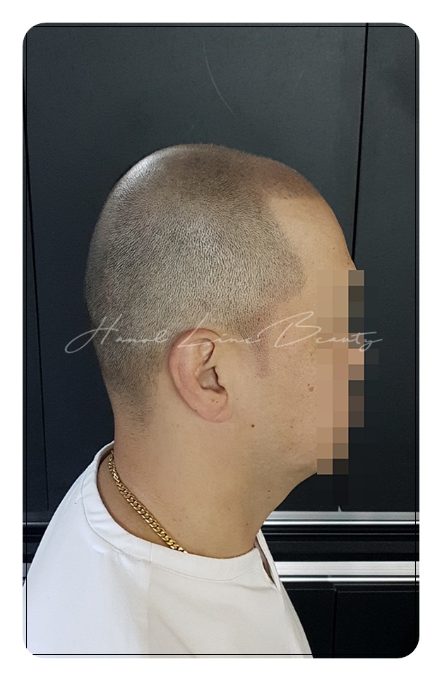 민머리문신
