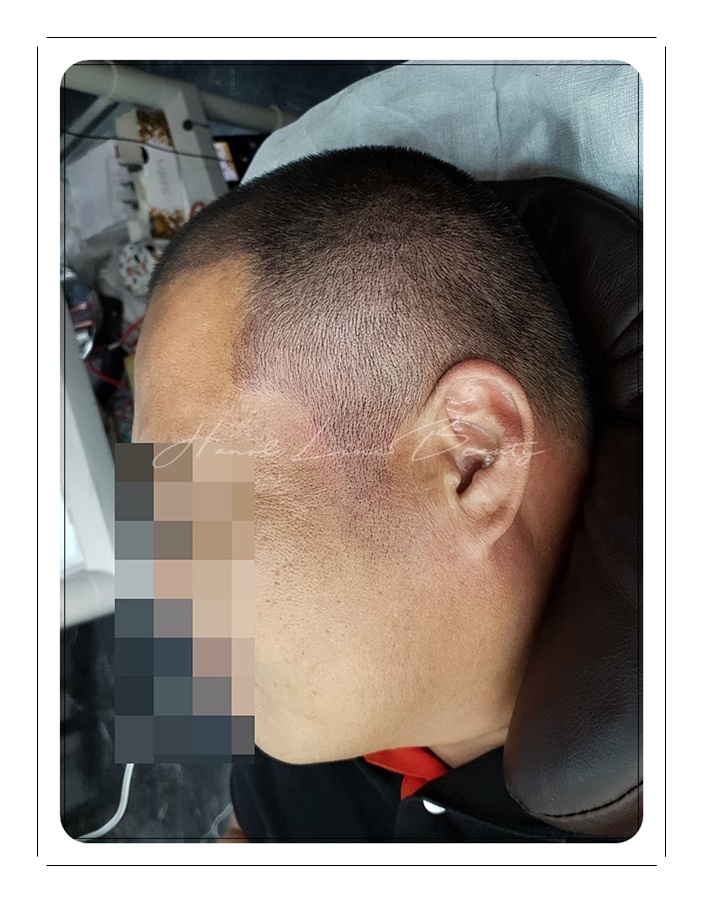 가르마문신