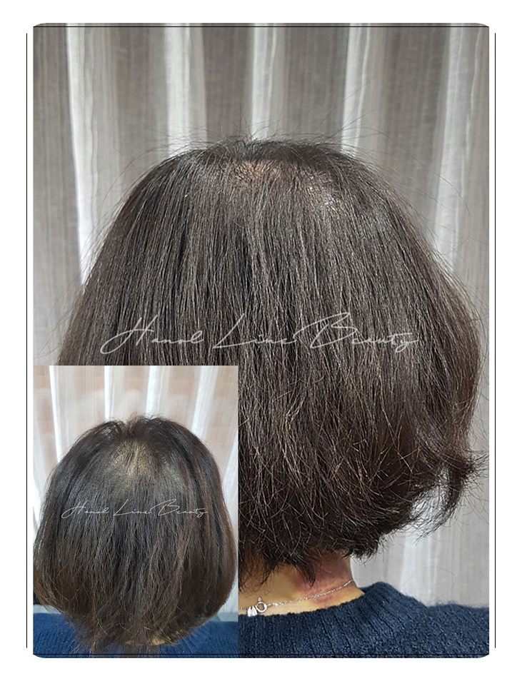 운양동두피문신
