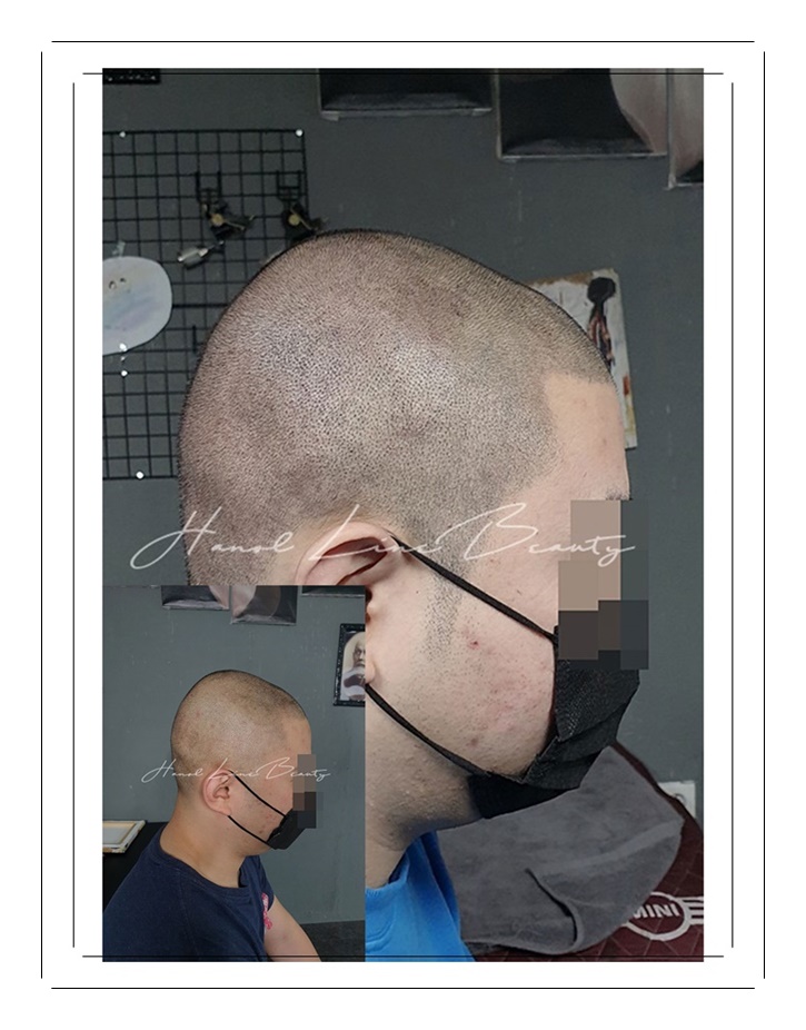 김포삭발문신