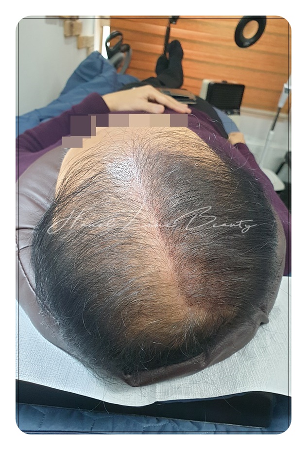 남성 50대후반