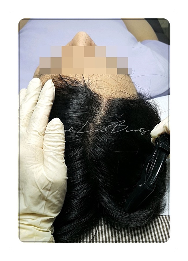 가르마문신