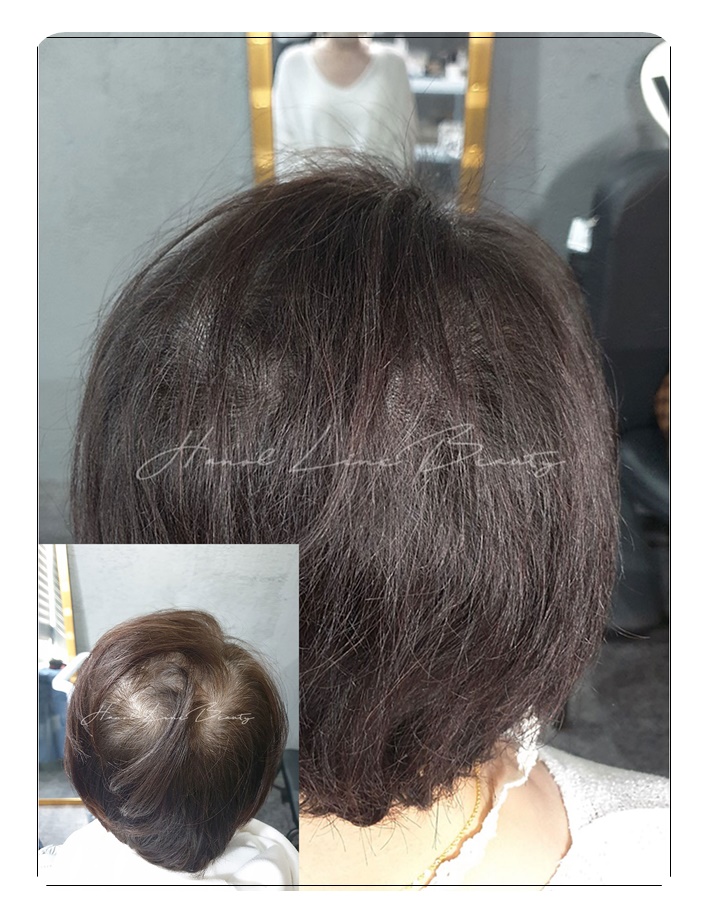 의정부두피문신