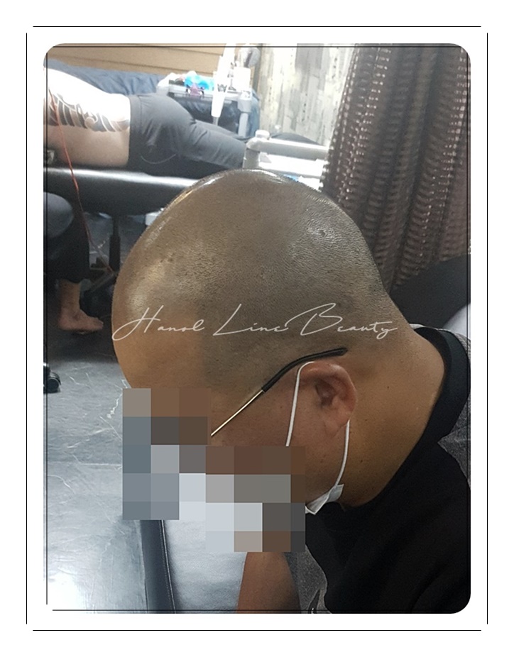 정수리두피문신