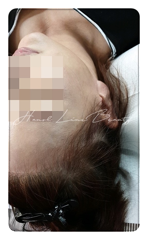 파주여성두피문신