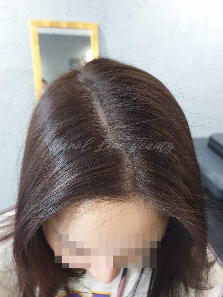 여성가르마문신