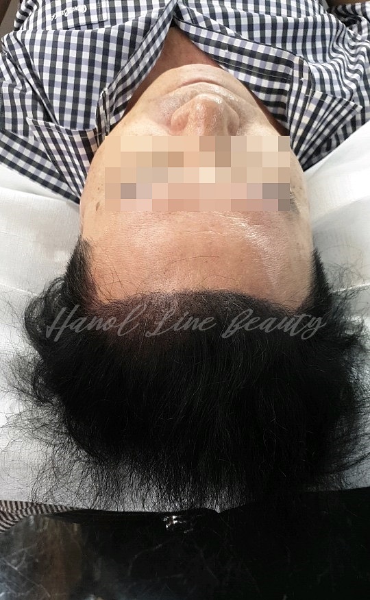 일산머리문신