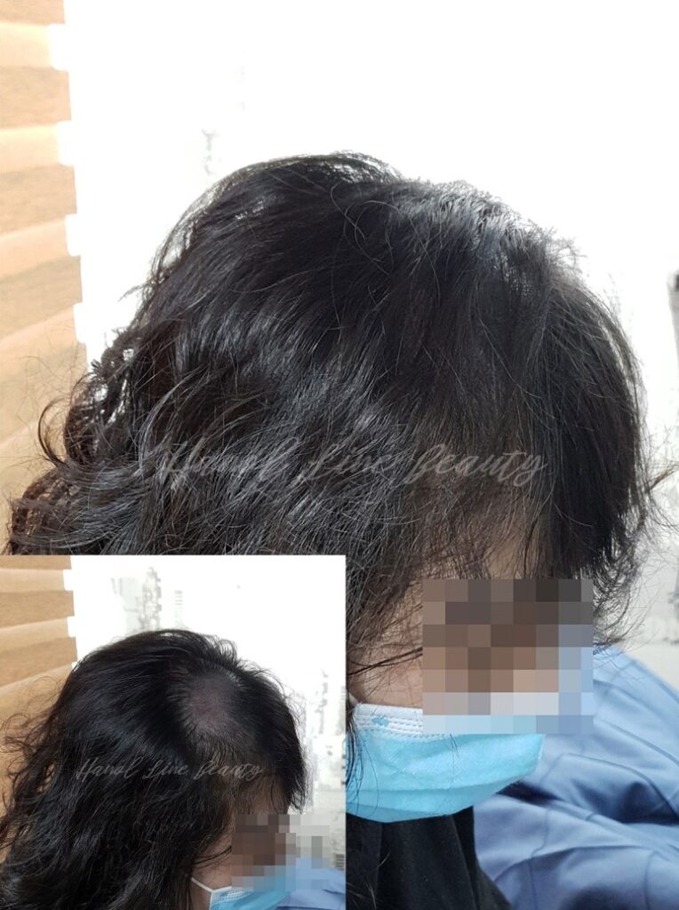 교하두피문신