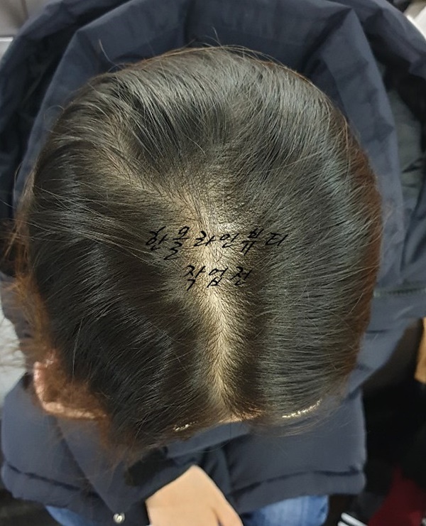 김포두피문신
