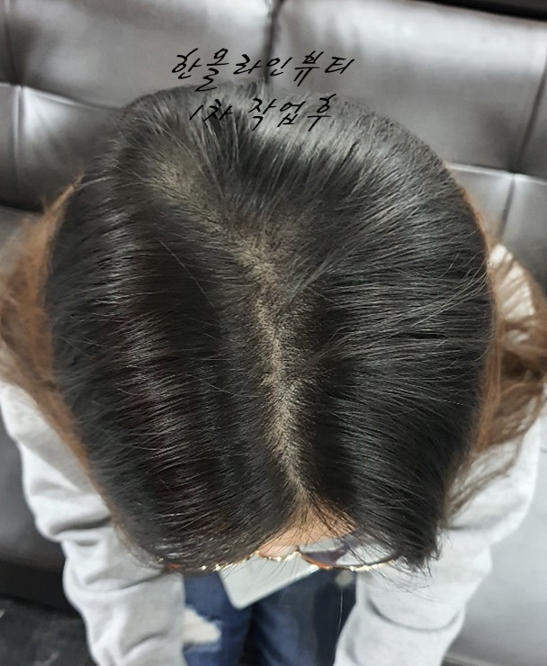 여성정수리탈모커버
