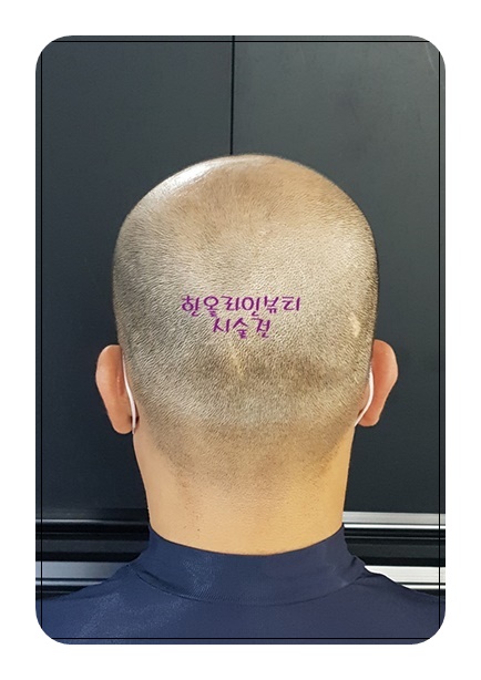 김포삭발문신