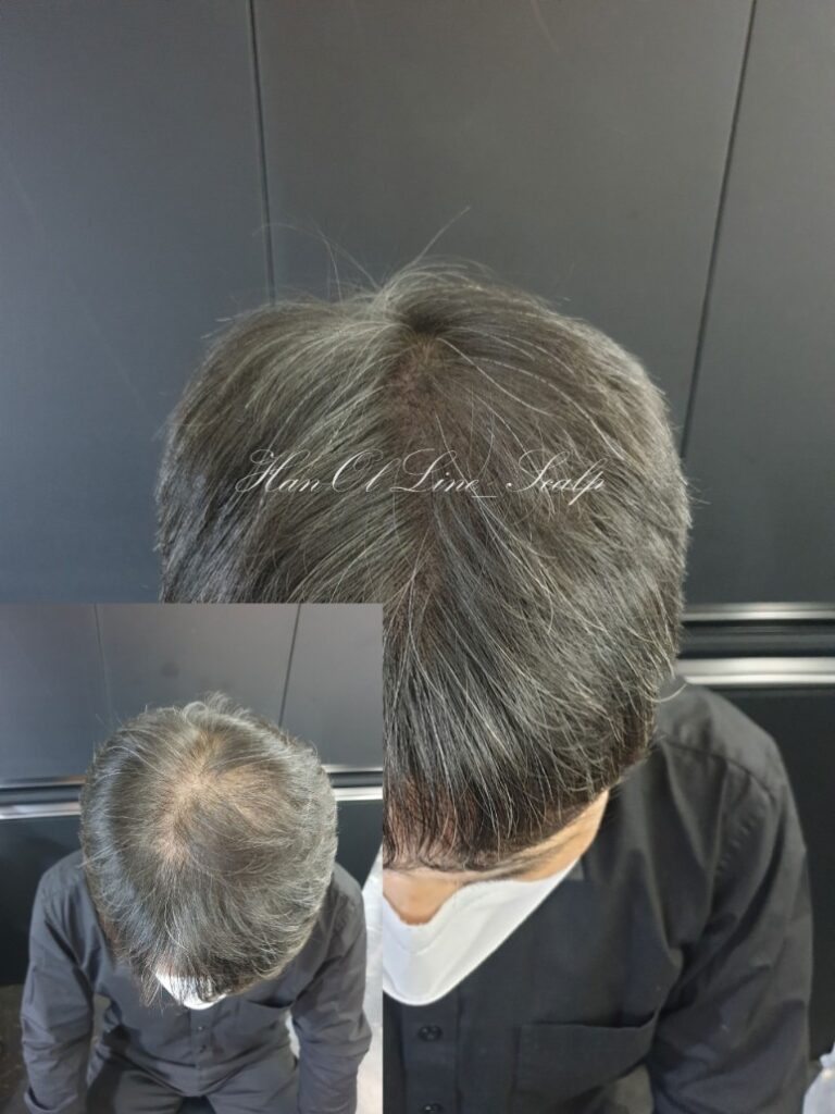삭발문신