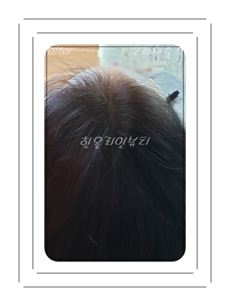 가르마문신