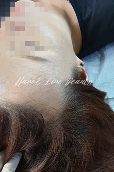 파주두피문신