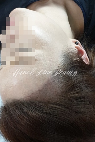 파주두피타투