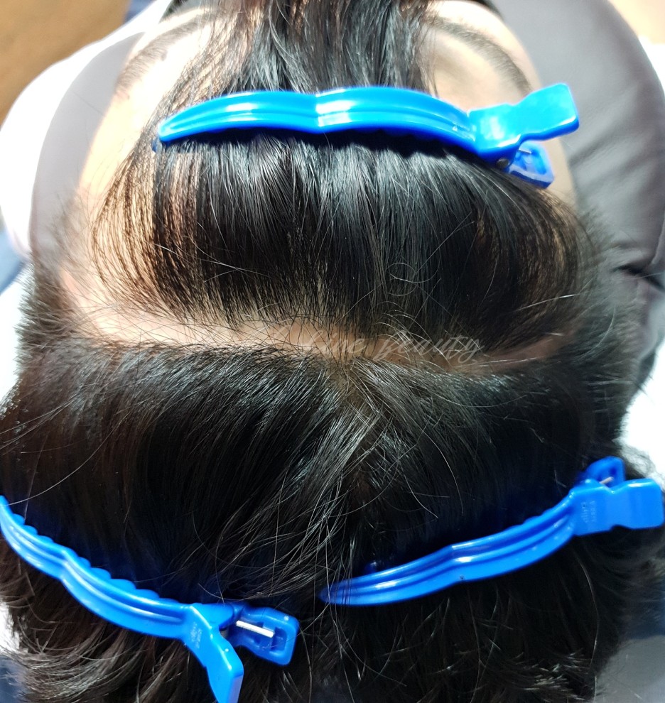 일산두피문신