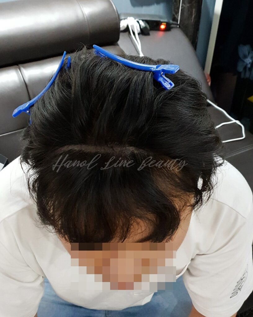 마두동두피문신