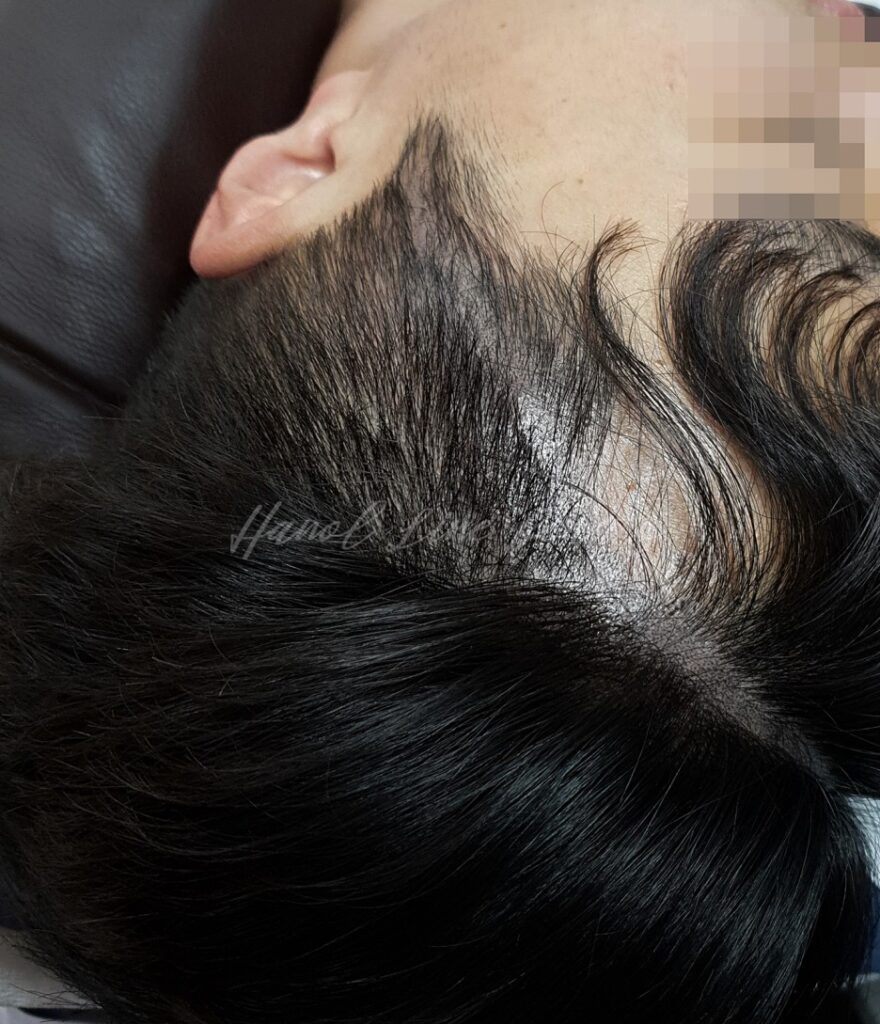 머리문신