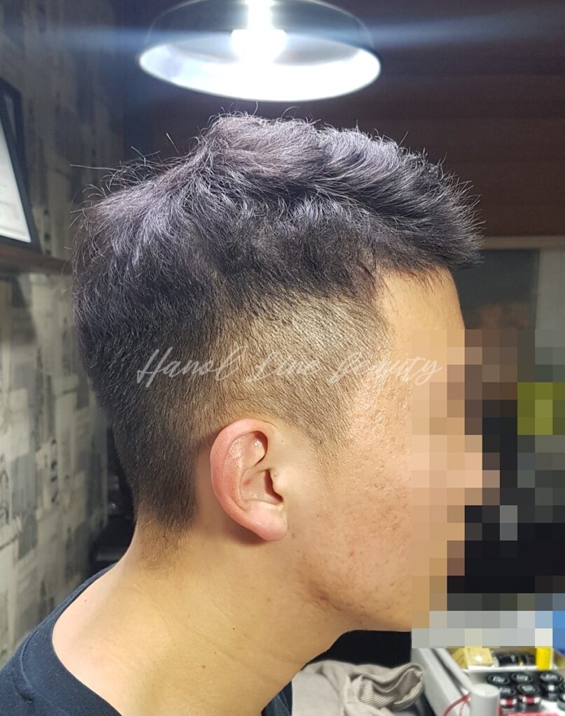 부천두피문신