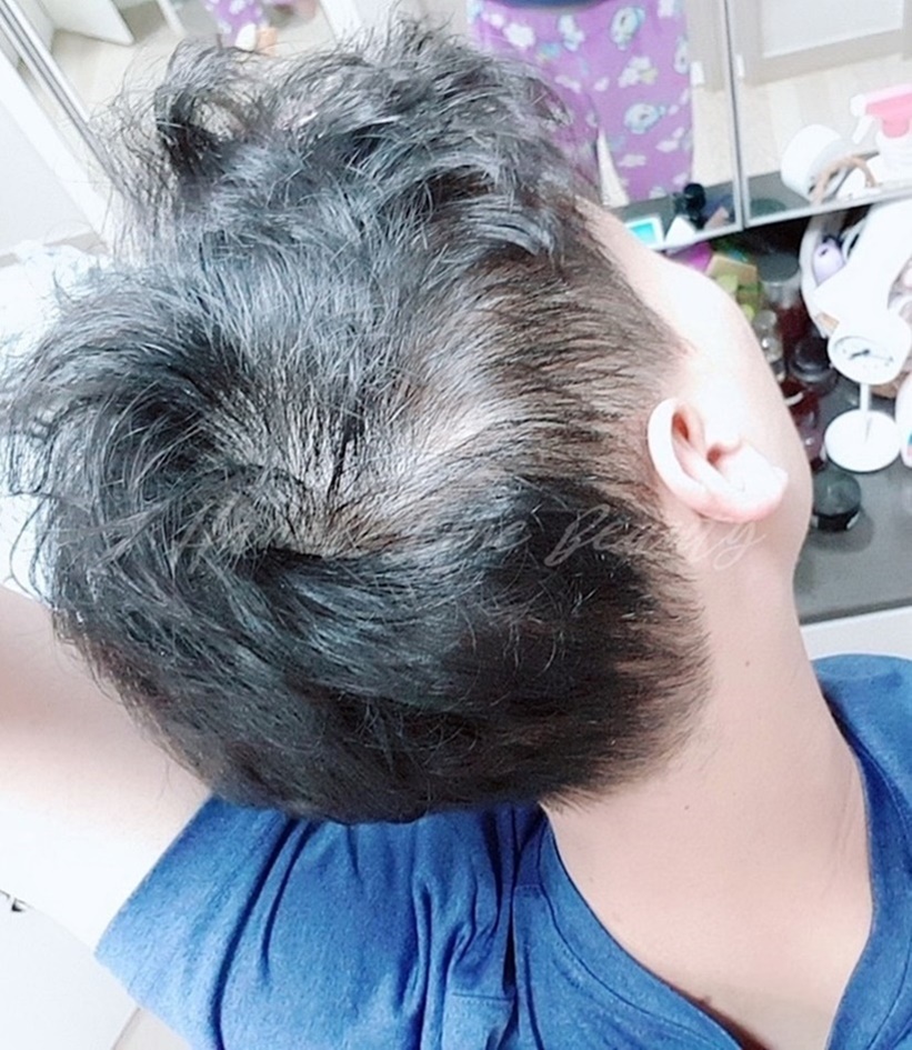 김포두피문신
