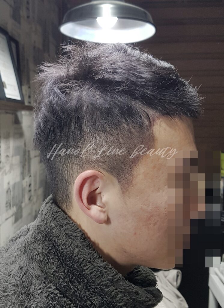 대안