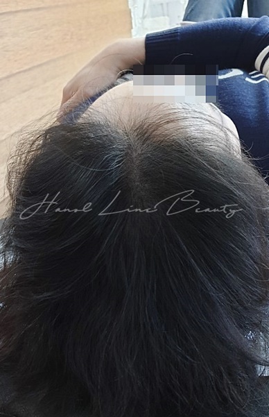 가르마문신