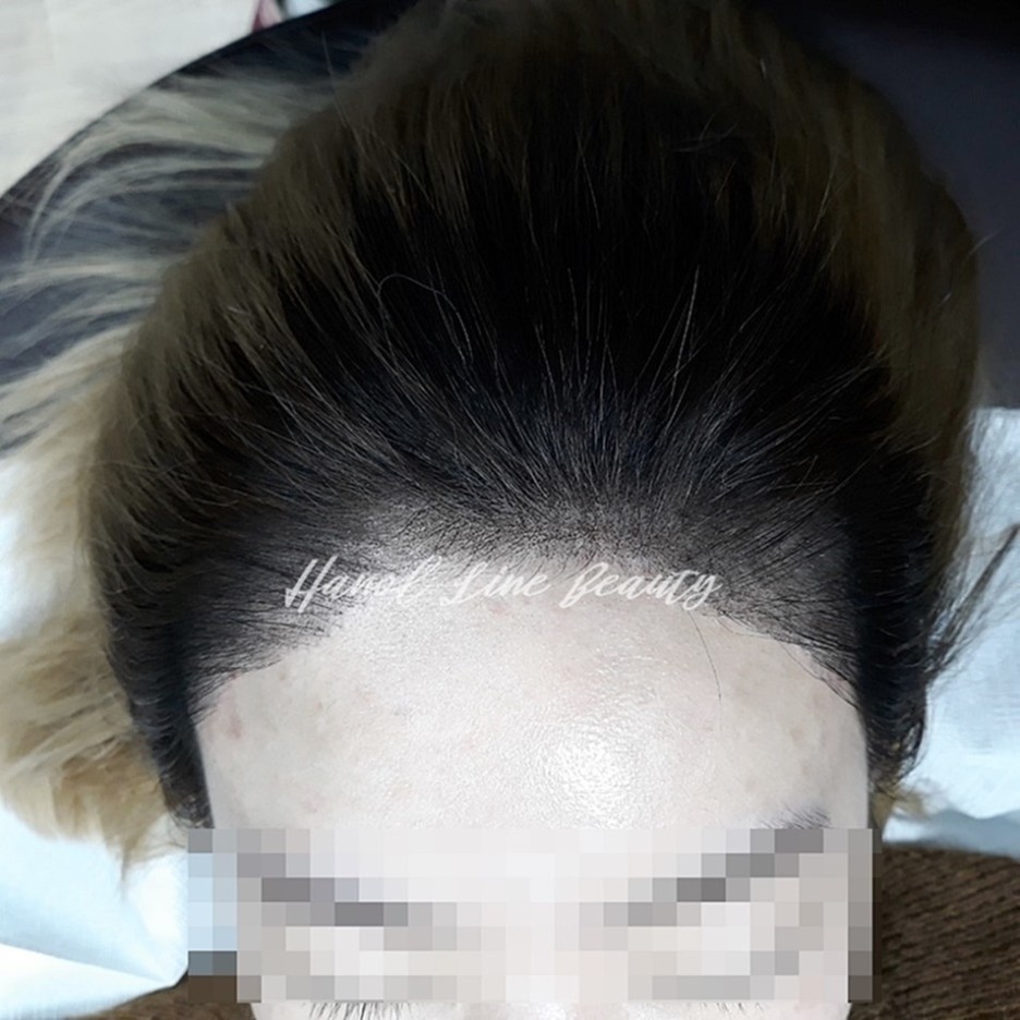 정수리두피문신