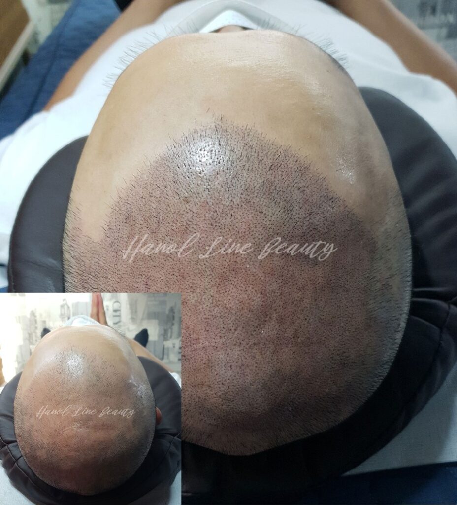 의정부삭발문신