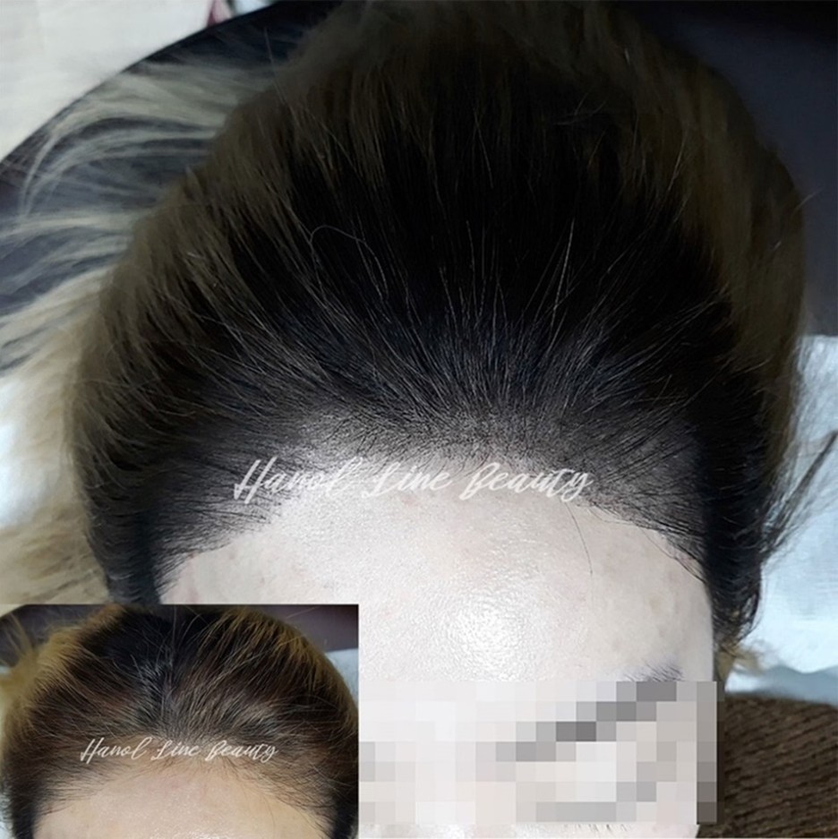 헤어라인문신