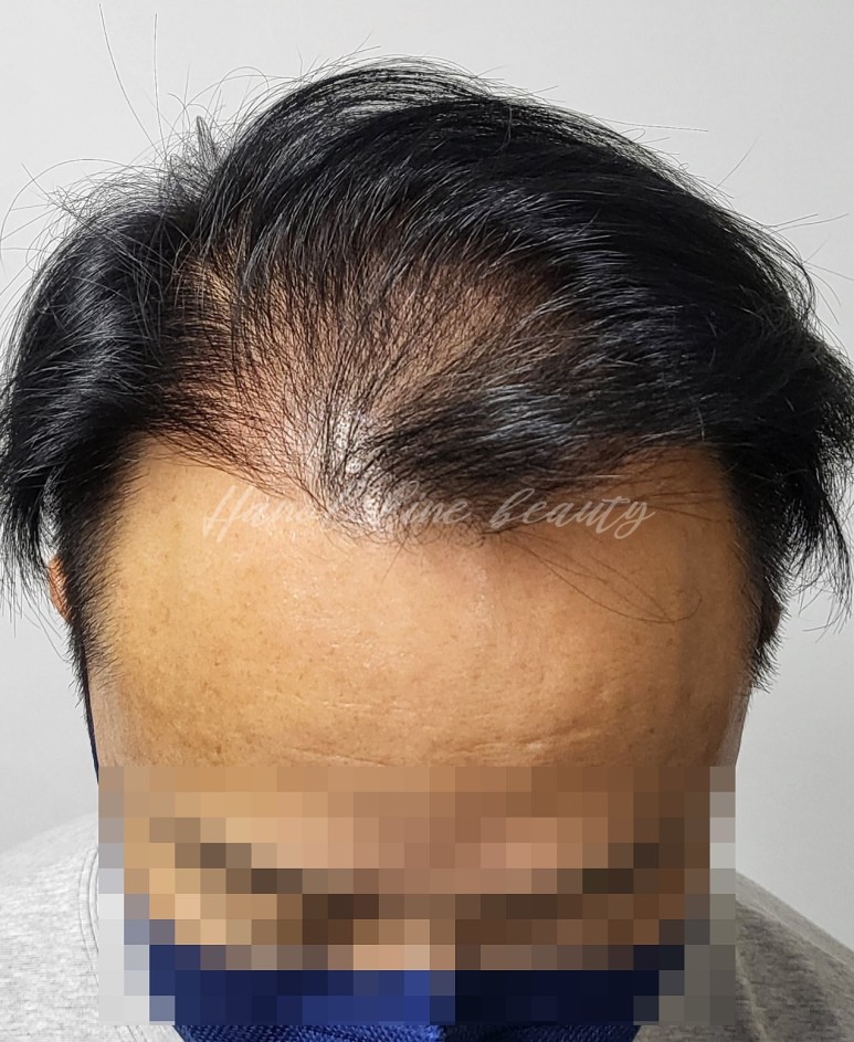 없어진
