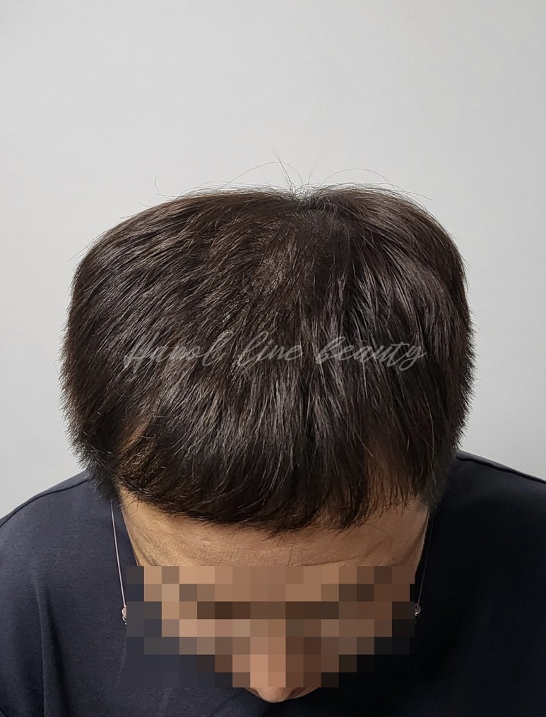가르마문신