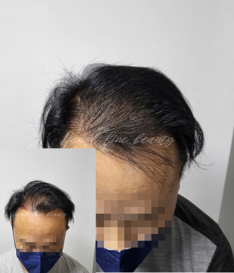 머리문신