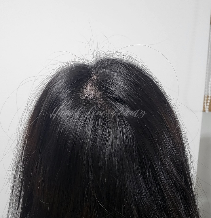 원흥두피문신